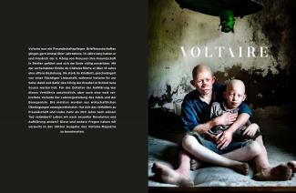 VOLTAIRE VOL III - Africans with Albinism